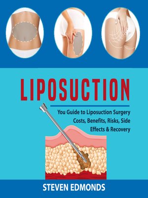cover image of Liposuction